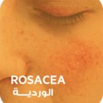 Face Care | العناية بالوجه